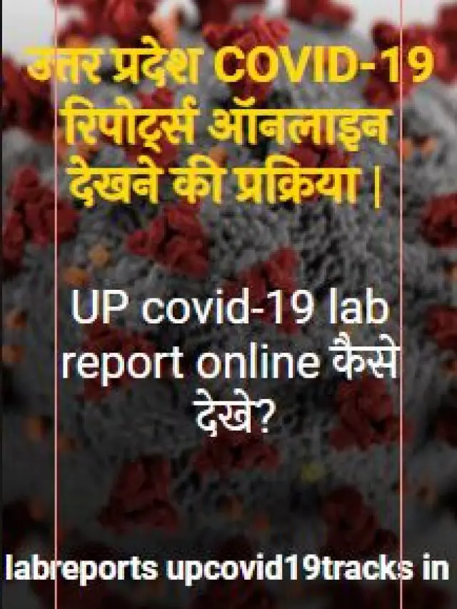 Read more about the article upcovid lab report